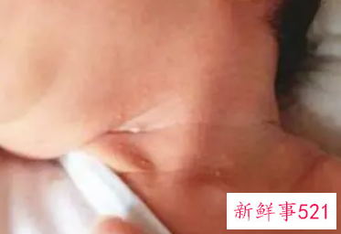 如何帮宝宝洗脖子