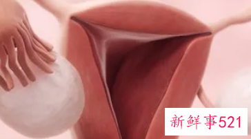 女性不排卵怎样治疗