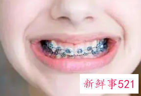 女性牙齿越来越黄怎么回事