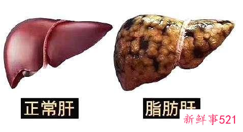 肥胖对身体的危害有哪些的