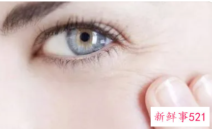 为什么我一笑满脸细纹