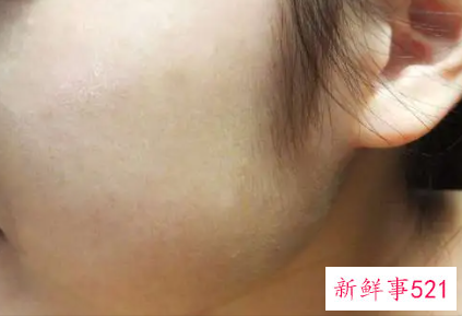 女人脸干性用是湿润亮光