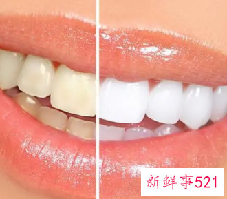 牙齿黄怎么办