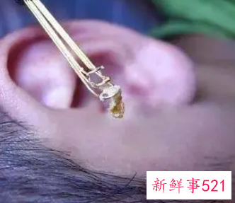 自己挖耳屎的时候要注意些什么
