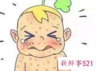 退烧了出疹子怎么办