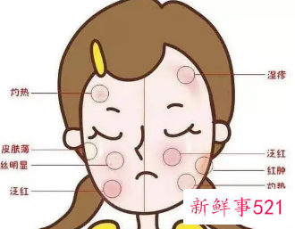 脸发痒发红起小粒粒怎么办