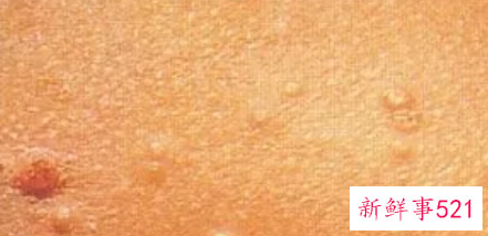 如何判断有没有性疾病