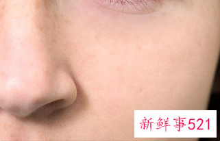 如何彻底清理脸部毛孔垃圾