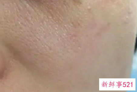 怎么化妆遮盖粗大的毛孔