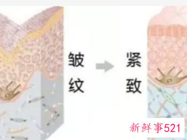 怎样使毛孔缩小生活小妙招