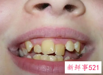 梦见别人生个孩子还有牙