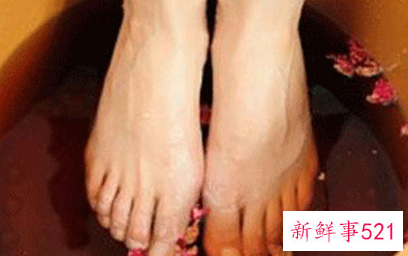泡脚有助于祛痘吗