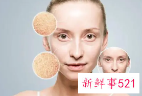 秋冬季节皮肤为什么会干燥起皮