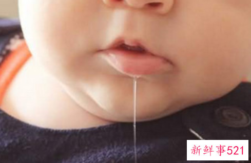 唾液的质与量都会影响口腔健康