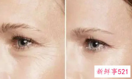 实用的除皱方法有哪些