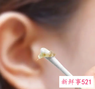 自己挖耳屎的时候要注意些什么