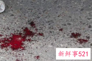 女人梦见下体出血