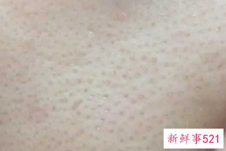 怎么化妆遮盖粗大的毛孔