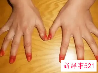 孕妇能用指甲桃花染指甲吗