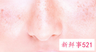 皱纹和细纹哪个更严重