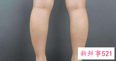 纠正腿粗的人方法
