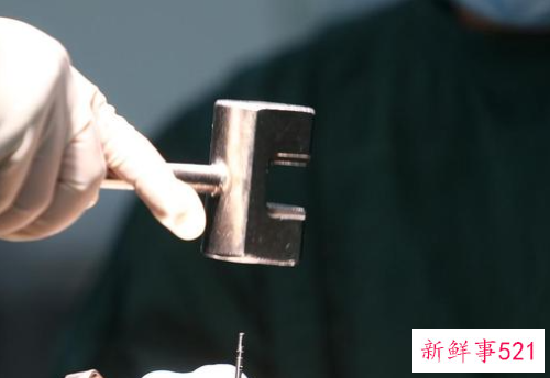 骨盆前倾危害以及原因