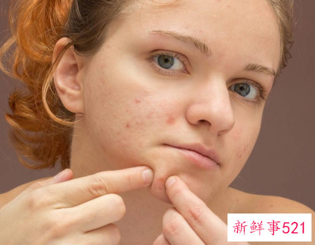 脸上发红的痘印怎么快速消除