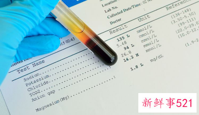 产前亲子鉴定怎么做