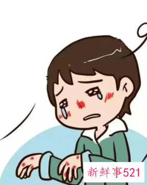 脸部冻伤发红怎么办