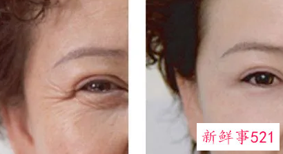 实用的除皱方法有哪些