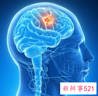 梦见头部被夹预示什么