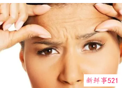 为什么我一笑满脸细纹