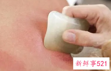 每天刮痧眉毛有啥好处