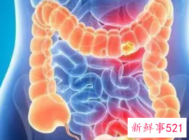 每天大便很规律但不成形