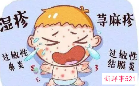 化妆品过敏该怎么办