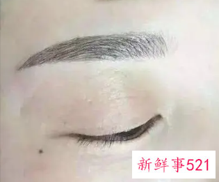 敷眉毛的麻药是什么