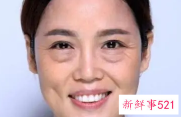 女人眼袋重与性有关吗