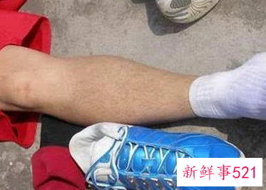 打篮球小腿抽筋的原因