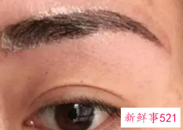 敷眉毛的麻药是什么