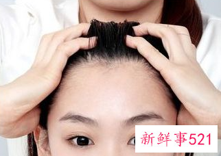 刘海总出油怎么办