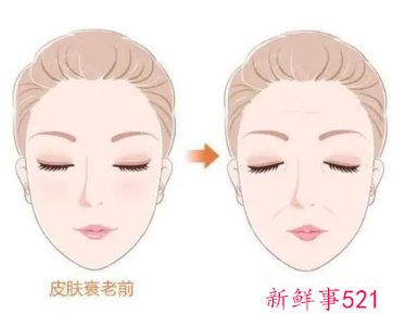 目前最火的抗衰老项目