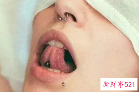 打舌钉的人是什么心态