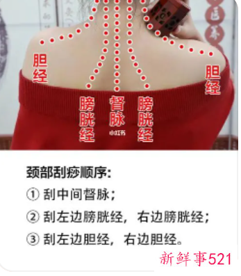 怎么刮痧背部图解