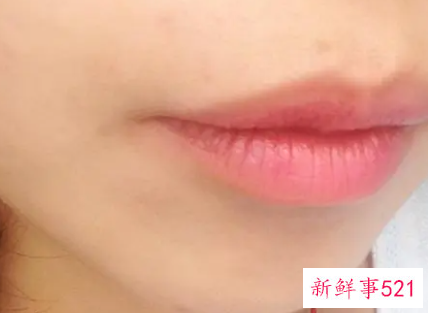 一勺盐两勺糖去唇毛有用吗