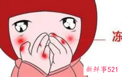 脸部冻伤发红怎么办