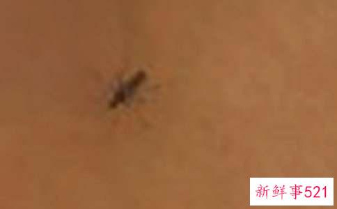 宝宝被蚊子咬了怎么办