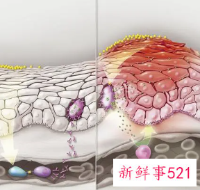 皮肤细胞更新周期