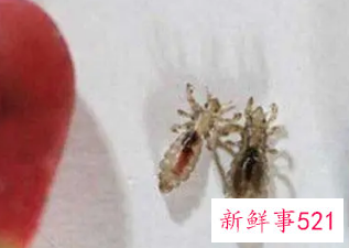 梦见身上有虱子并掐死