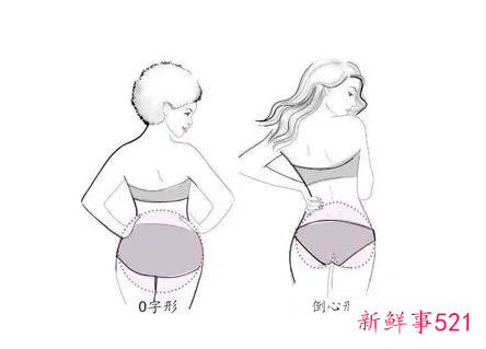 屁股大的原因臀部