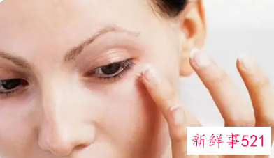 为什么我一笑满脸细纹